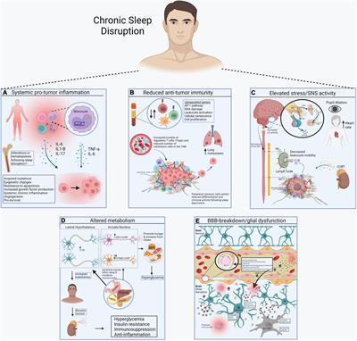 Sleep Disruption and Cancer: Chicken or the Egg?